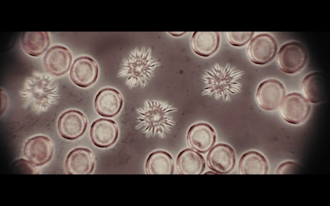 Funny how alien blood cells are always spiky...